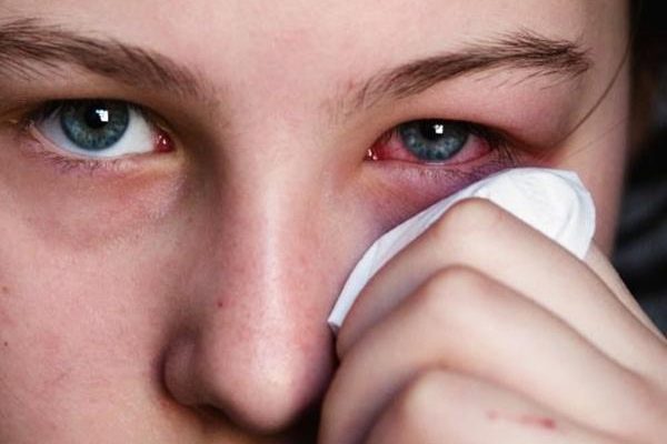 Sự thật về kính áp tròng ít người biết